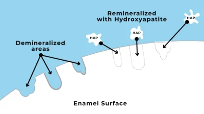 Natural Hydroxyapatite Toothpaste (full size) - Image 2