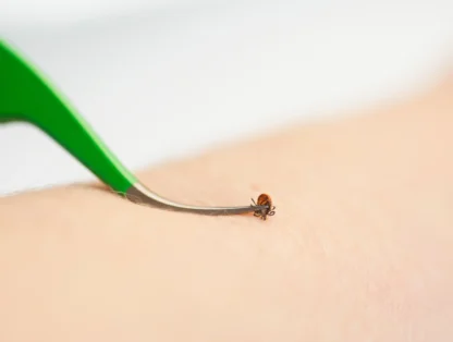 TickCheck Premium Tick Remover Kit - Image 5